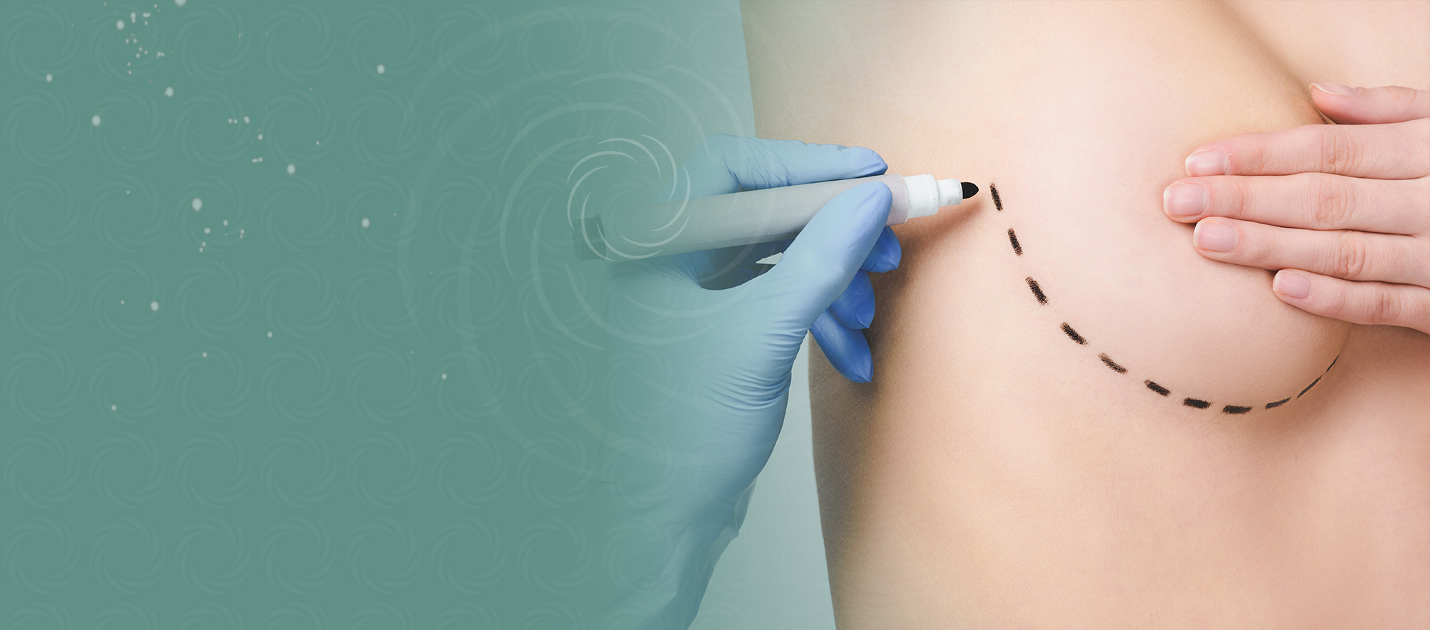 chirurgia piersi banner