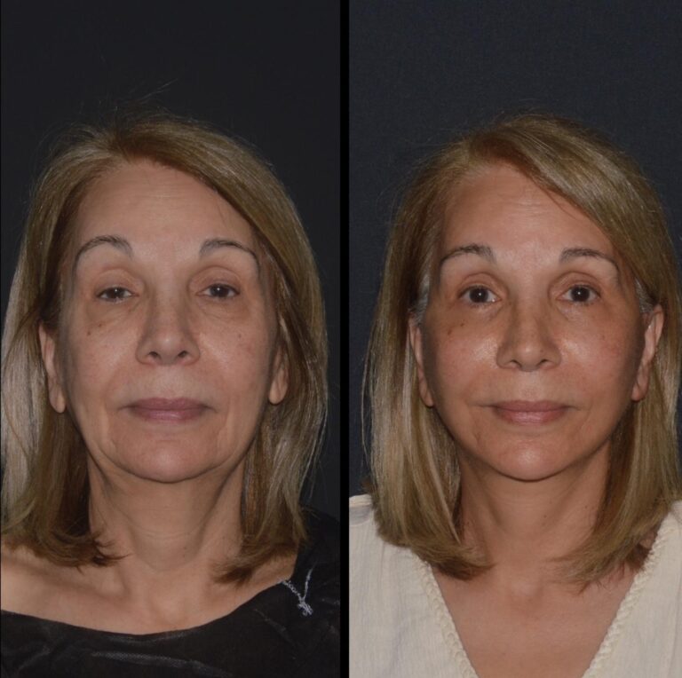 chirurgia twarzy 1 1