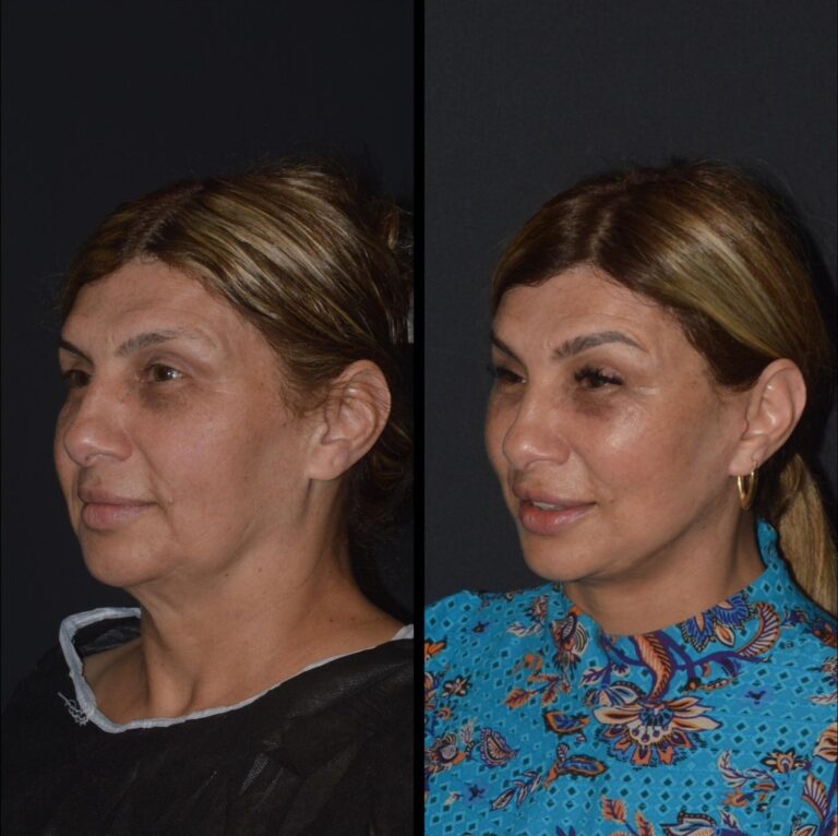 chirurgia twarzy 1 10