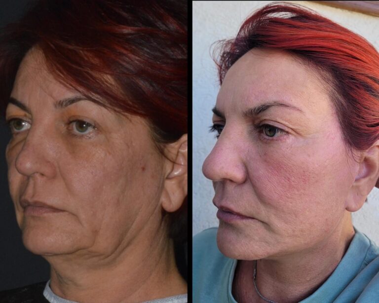 chirurgia twarzy 1 12