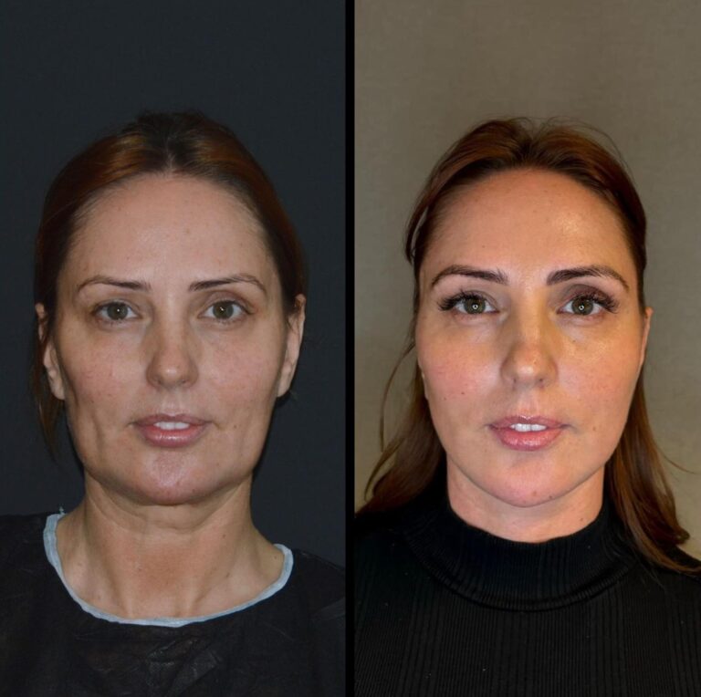 chirurgia twarzy 1 2