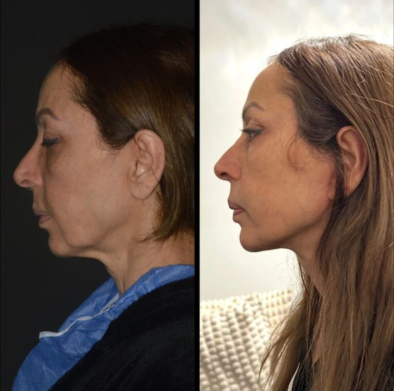 chirurgia twarzy 1 6