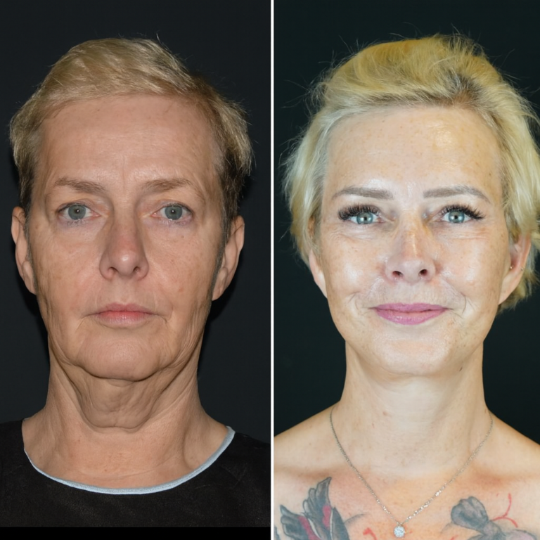 chirurgia twarzy 1 6