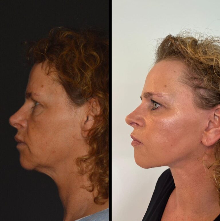 chirurgia twarzy 1 8